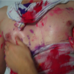 Other Side of the Thrill – part 3 – caring